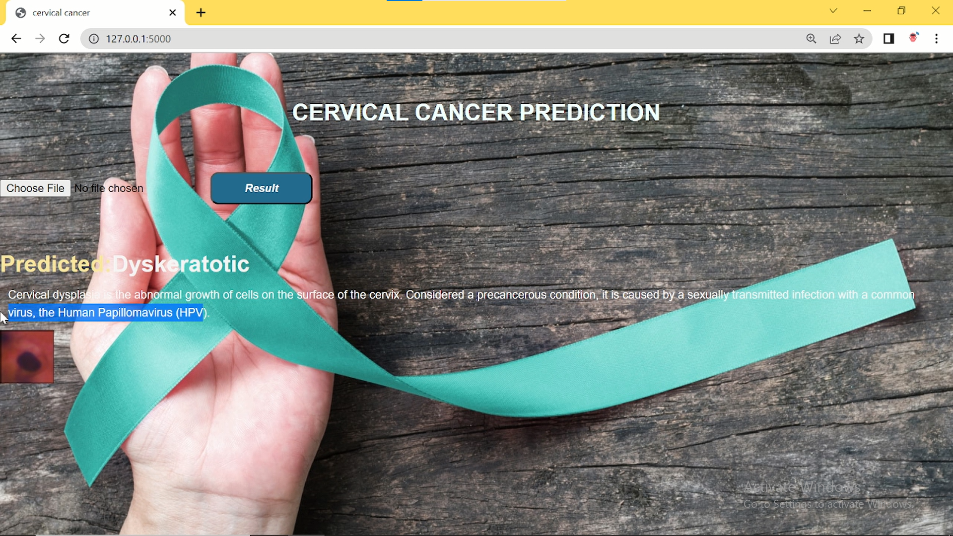 Cervical Cancer Type Classification Using Convolutional Neural Networks